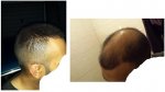 beforeafter.jpg