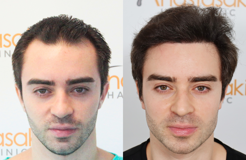 ΖΕΝΕΤΟΣ (1).png