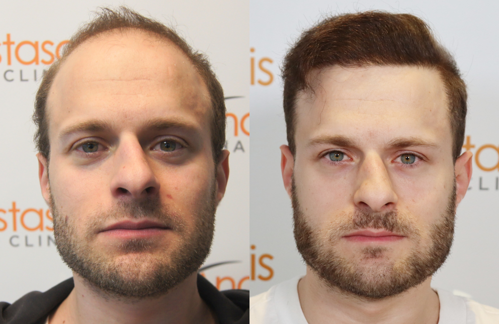 ΣΥΡΙΑΝΟΣ (2).png