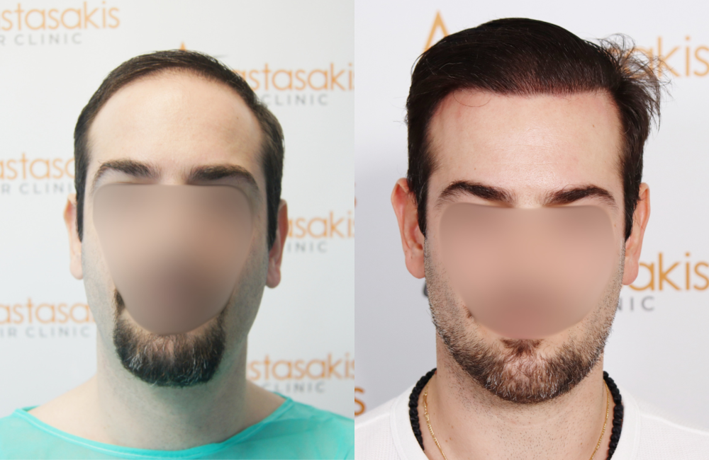 ΤΟΤΟΜΗΣ.png