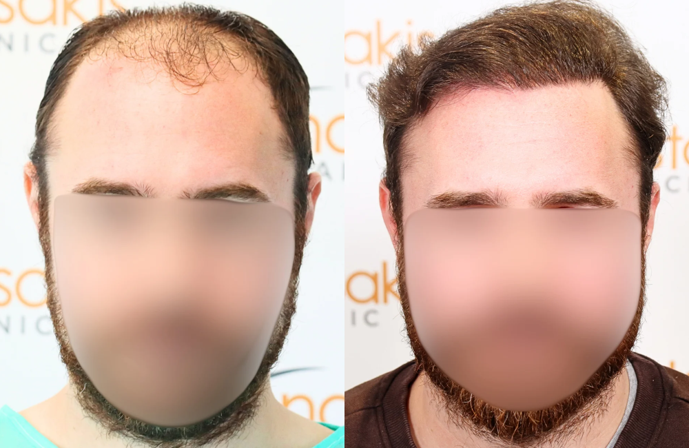 ΦΑΣΟΥΛΟΠΟΥΛΟΣ.png