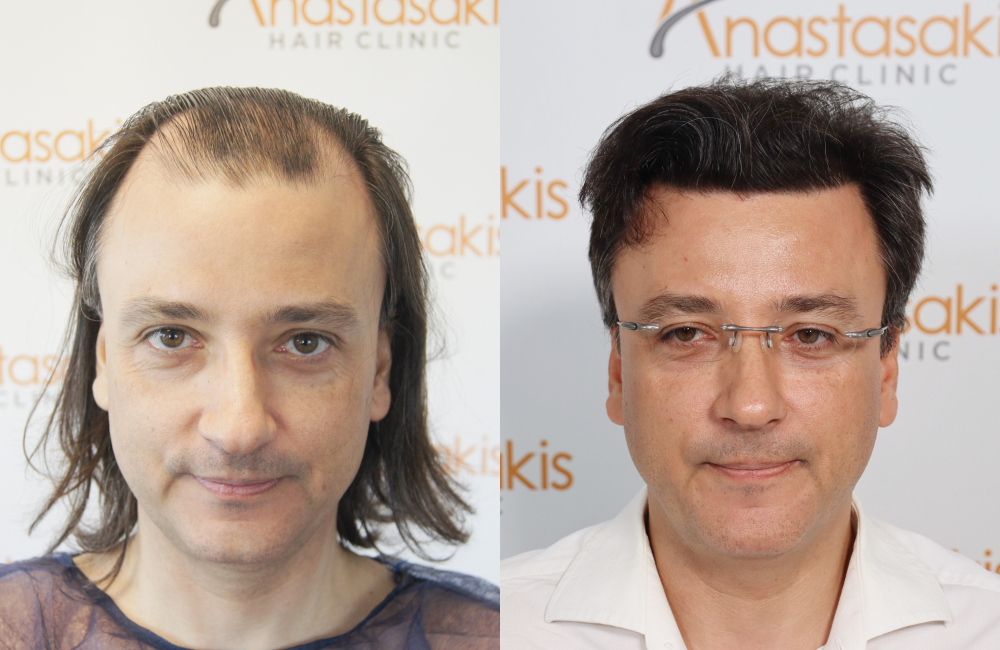 ΧΑΤΖΗΑΓΓΕΛΟΓΛΟΥ.png