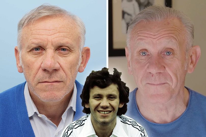 0_Peter-Reid-hair-transplant.jpg