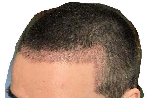 1.png.93ea6459e48e2037e3541758d003e22a.png