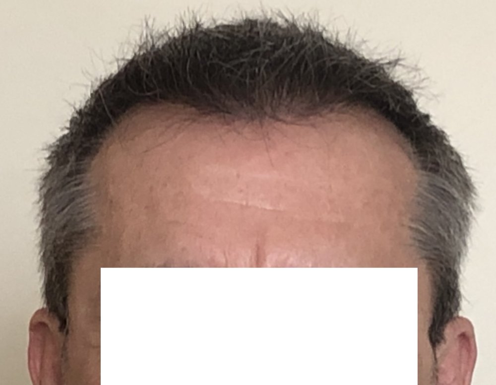 10.5 months after haircut 4164.JPG