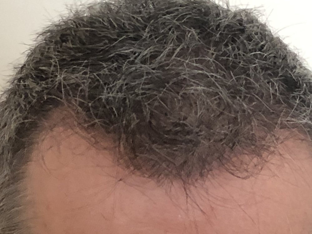10.5 months after haircut 4166.JPG