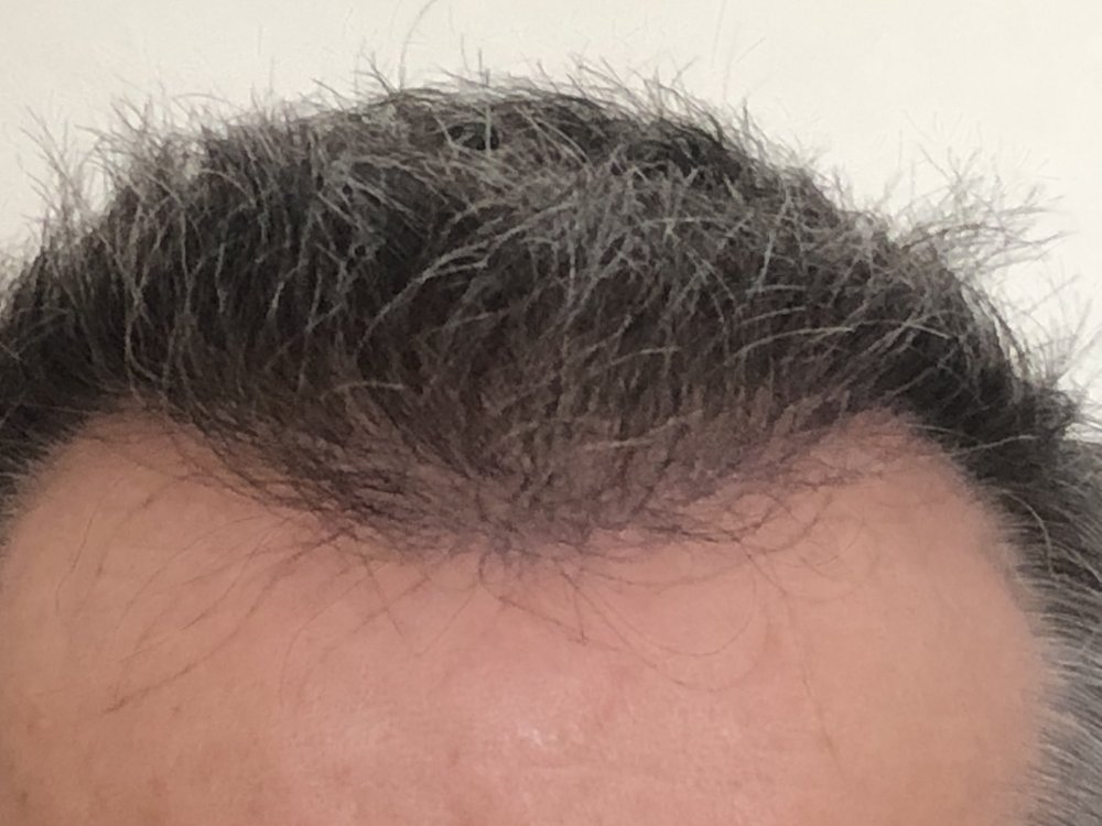 10.5 months after haircut 4168.JPG