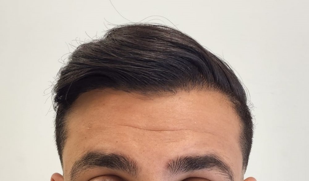 10. After Front without face.jpg