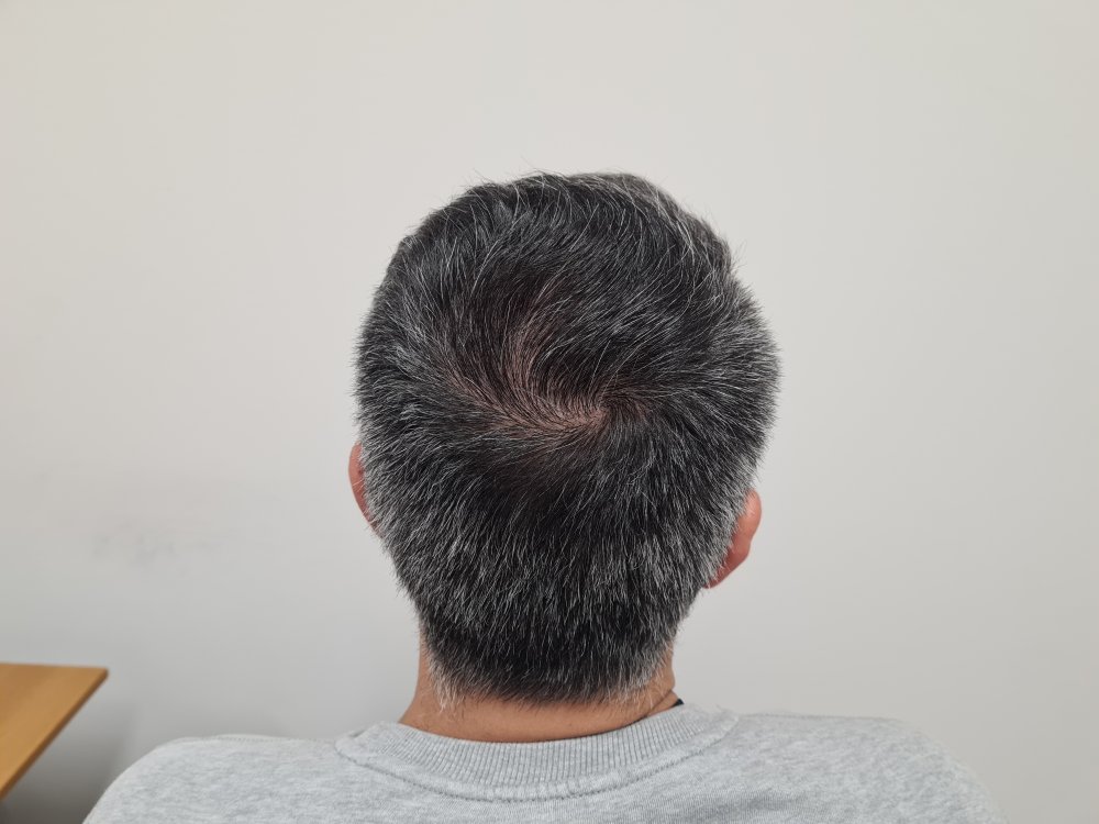 10. Donor back.jpg