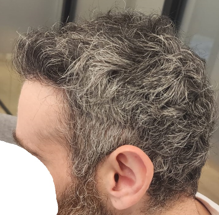 10. side View After.jpg