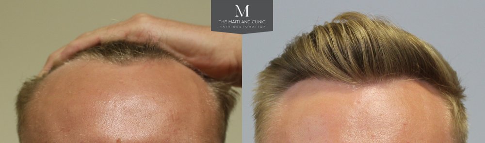 122 Double Front.jpg