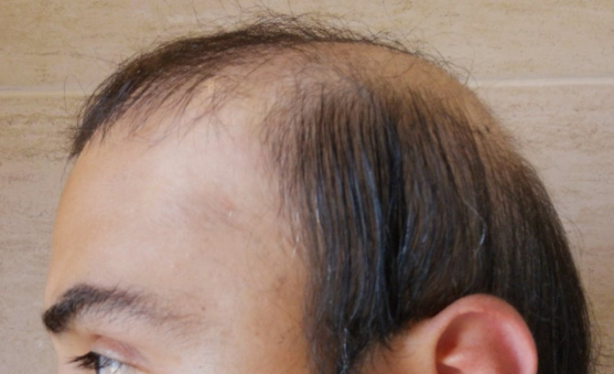 1657490001728.png