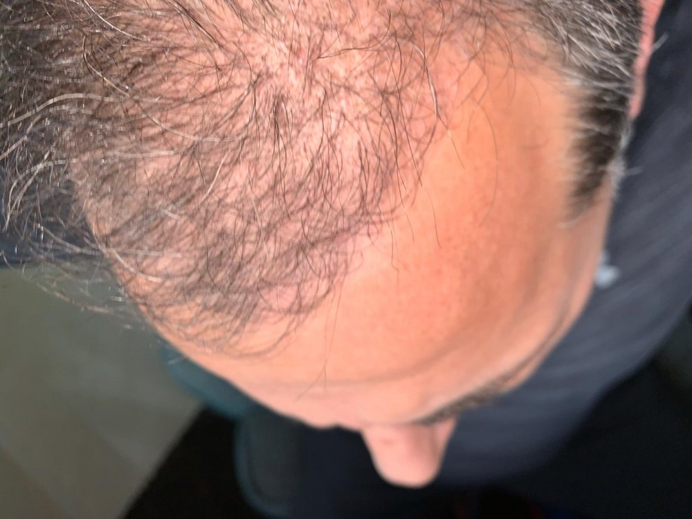 2.5 months 1.jpeg