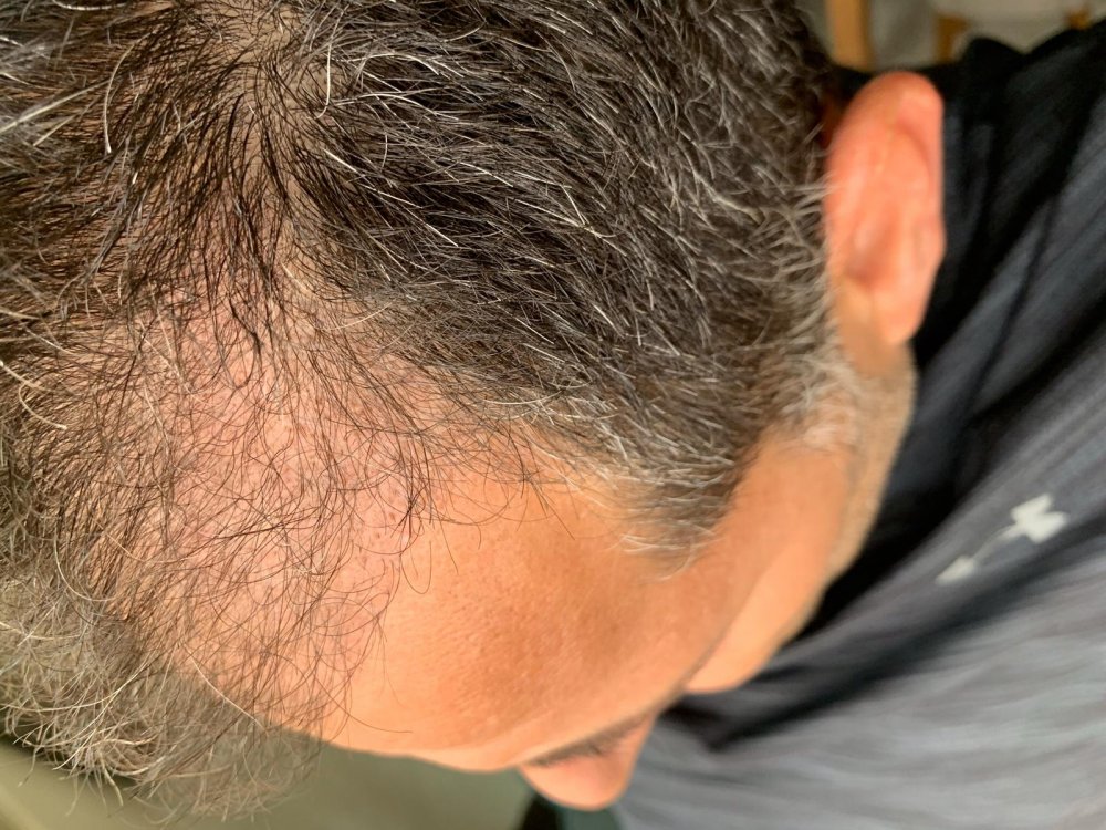 2.5 months 3.jpeg