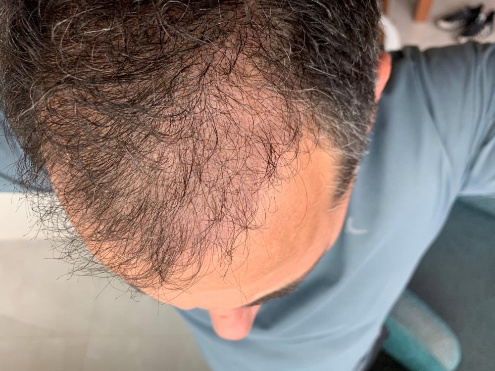 2.5 months 5.jpeg