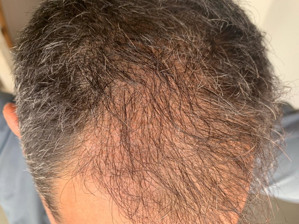2.5 months 6.jpeg