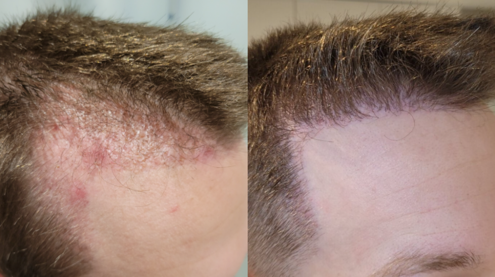 .2.png