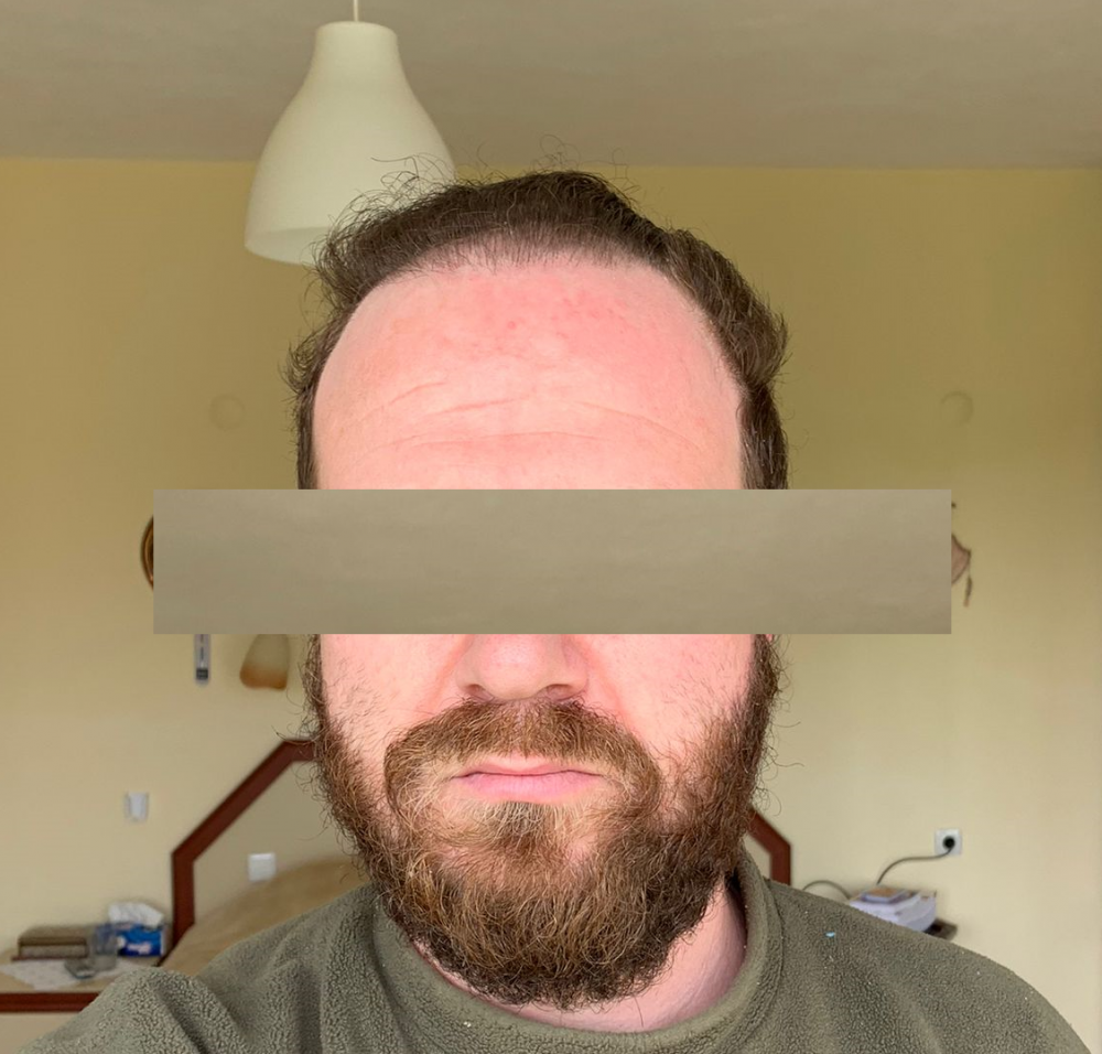 21.png