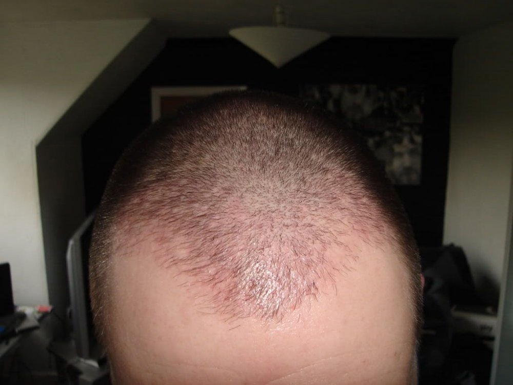 2monthsfront BHR Clinic.jpg