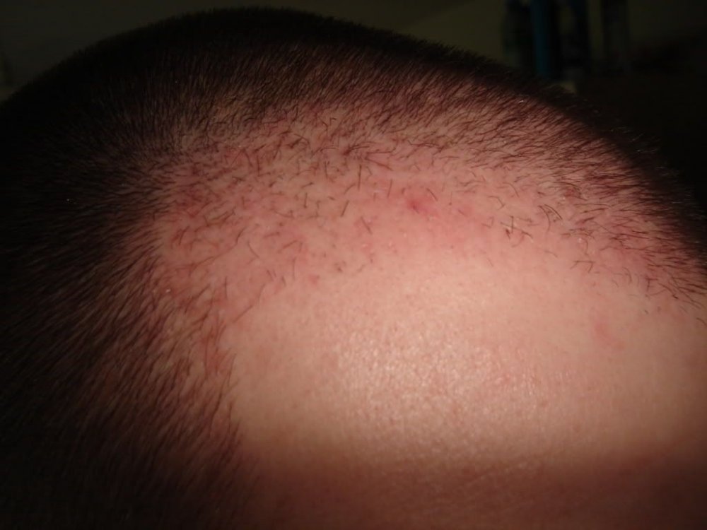 2monthsright BHR Clinic 1.jpg