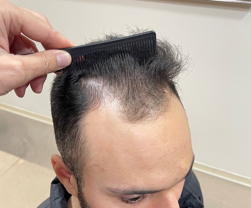 4. Recipient before.jpg