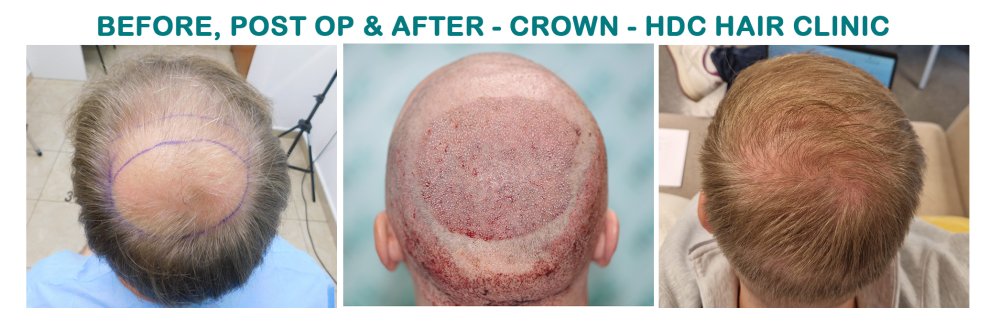 6. comparison with natural result.jpg 6. comparison with natural result.jpg