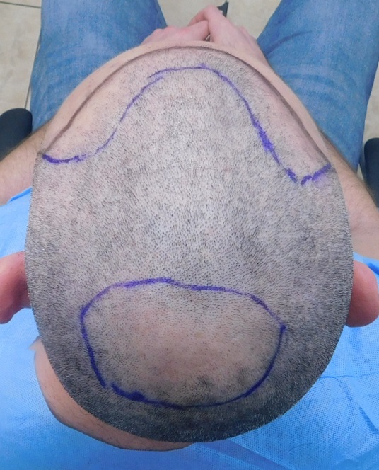 6a. Crown design.JPG