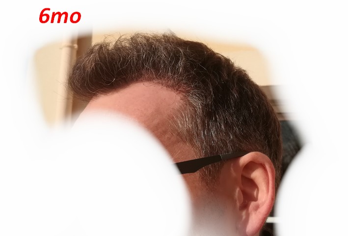 6mo_1_1024.jpg