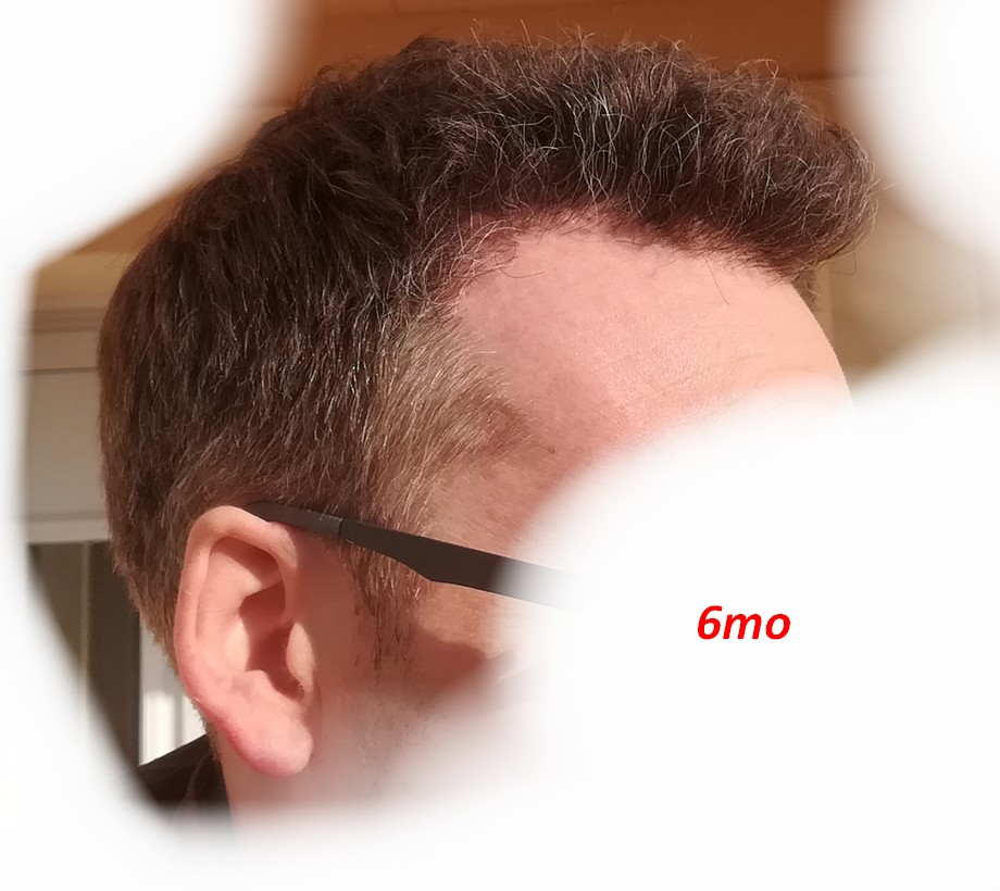 6mo_2_1024.jpg