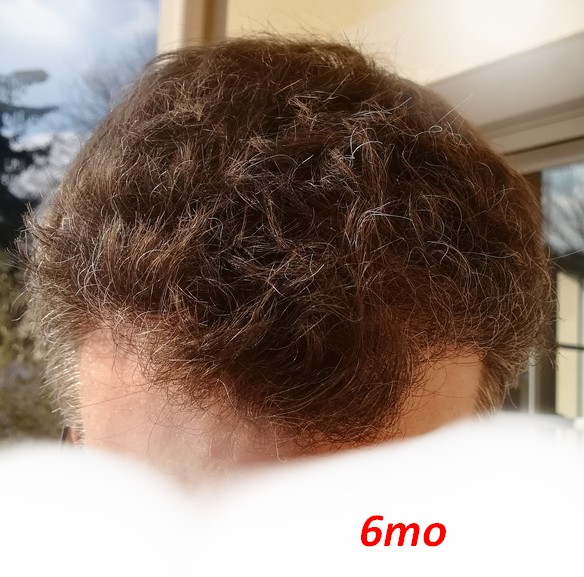 6mo_4_1024.jpg