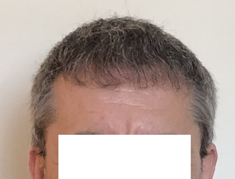 8.5 months 3685 fringe.JPG