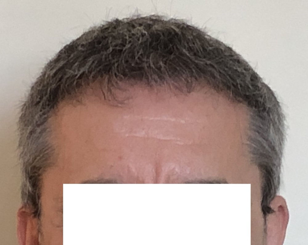 8.5 months 3691 - no fringe.JPG