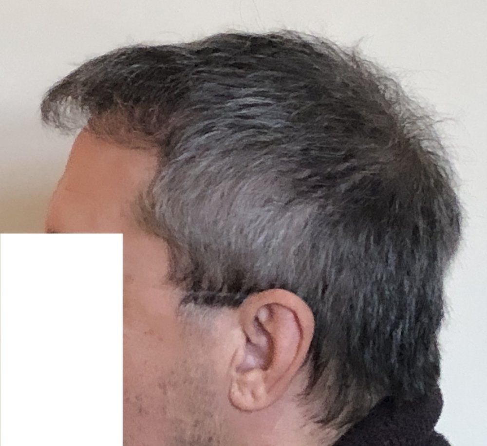 8.5 months 3693  no fringe.JPG