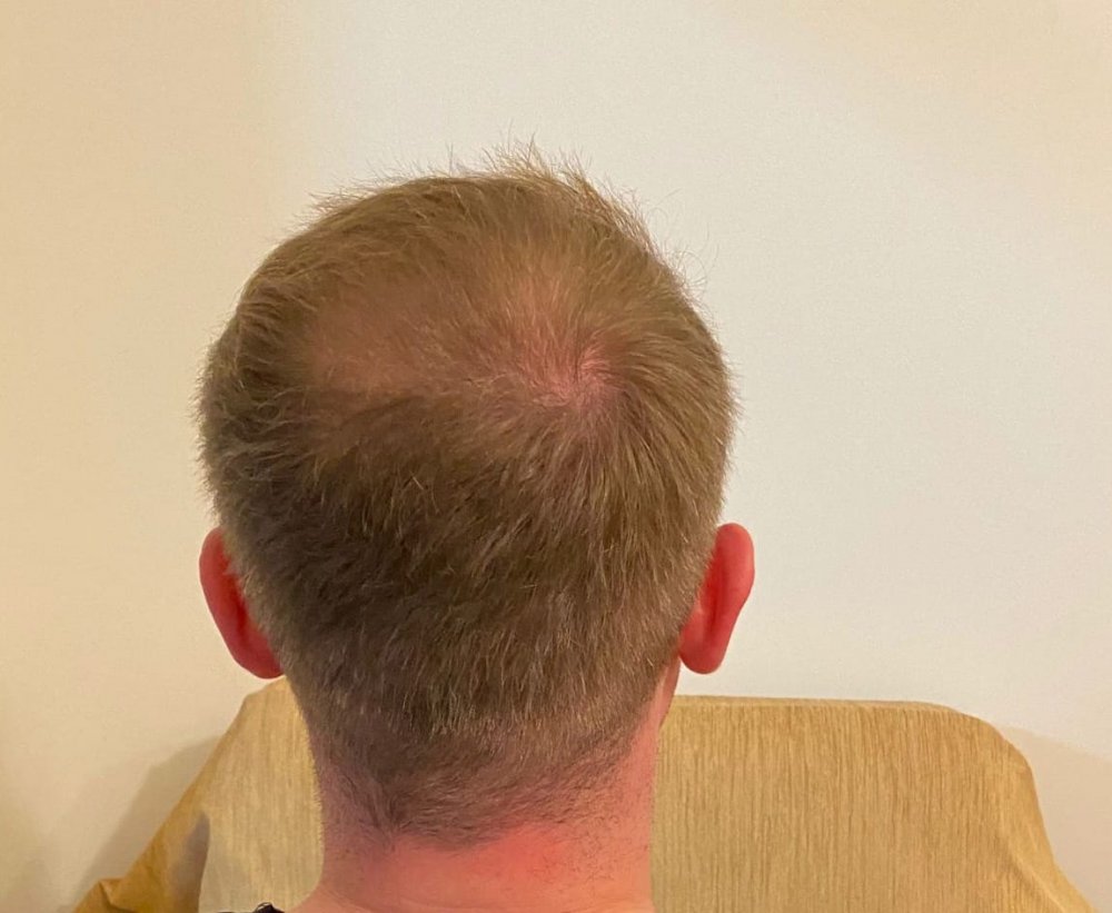 8 months ...jpg