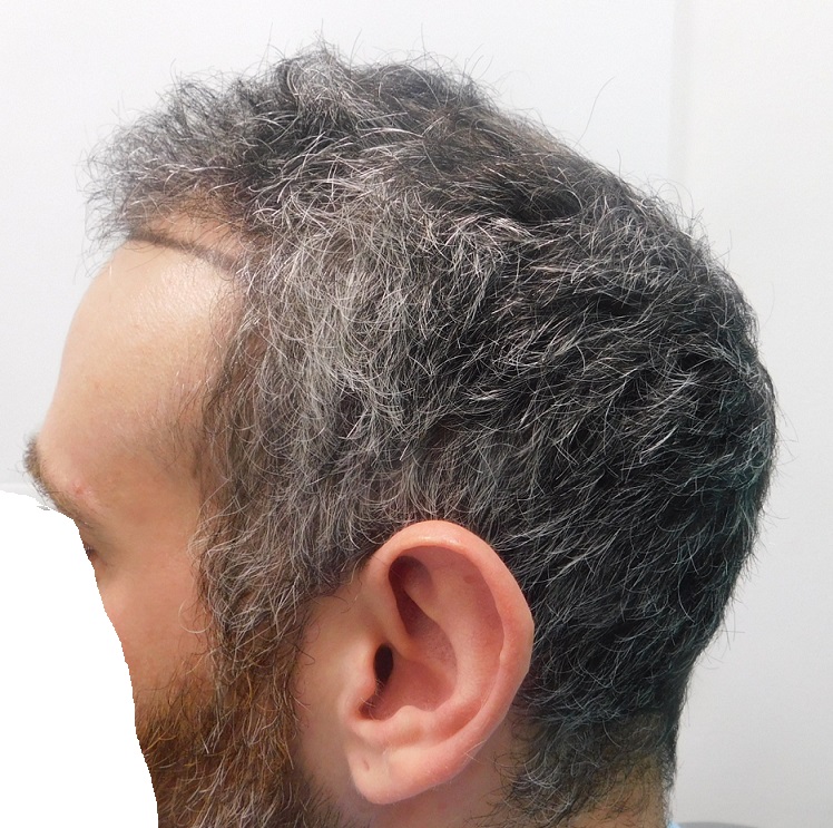 9. side View Before.JPG