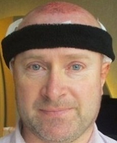 AEK Clinic, Dr Ali Emre Karadeniz9.JPG
