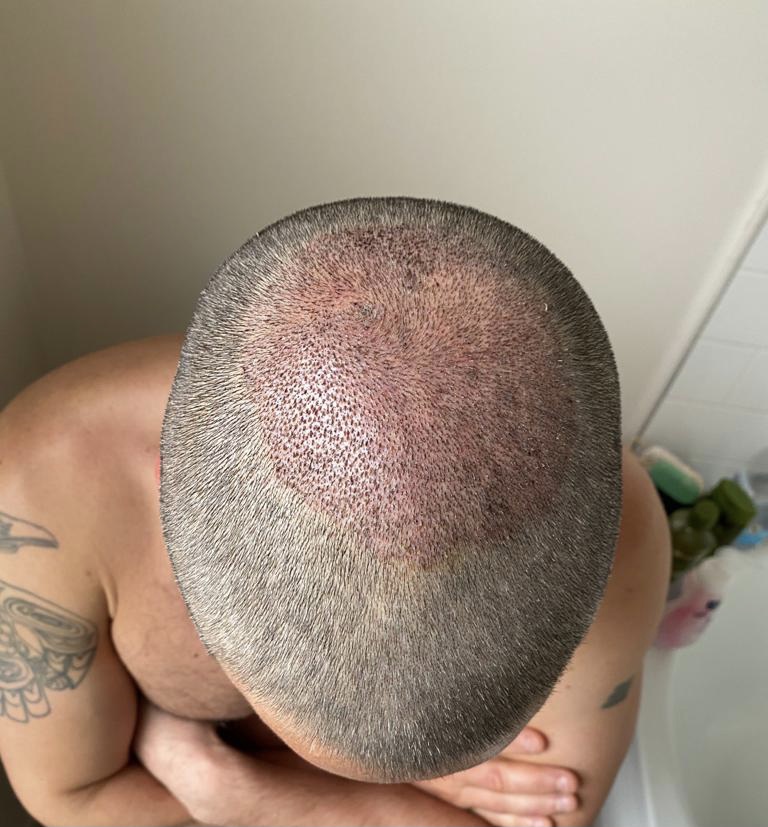 After.jpg