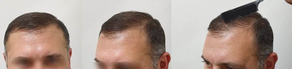 after.jpg