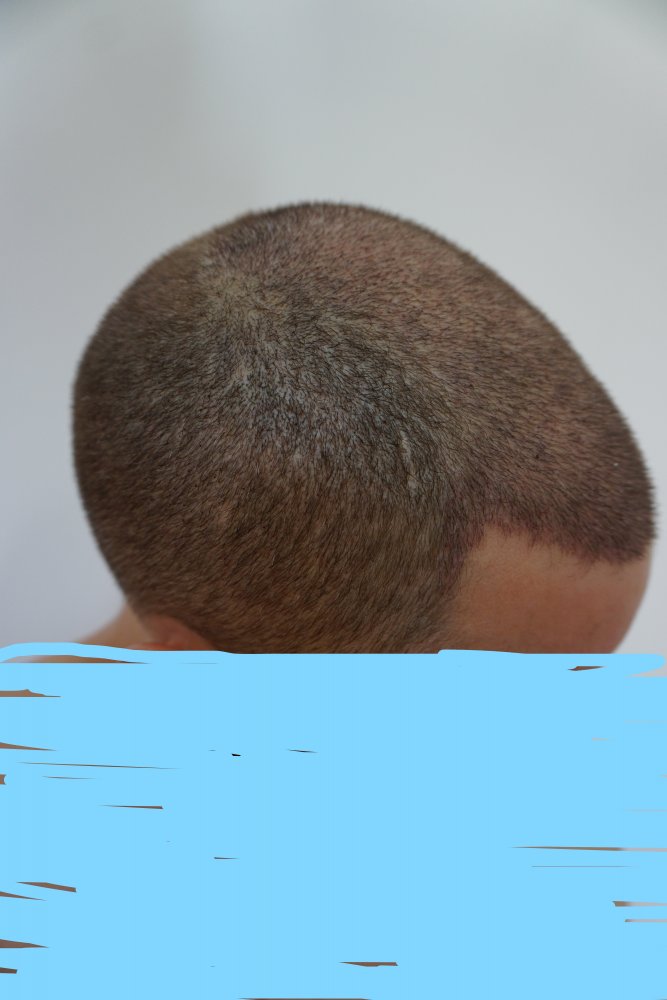 After one week 4.jpg