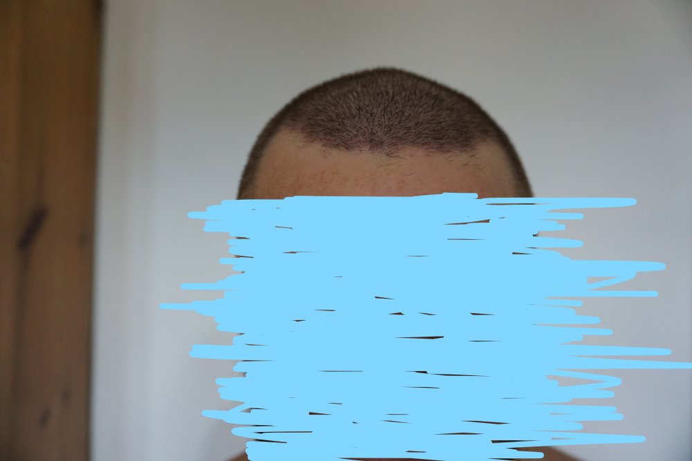 After one week 5.jpg