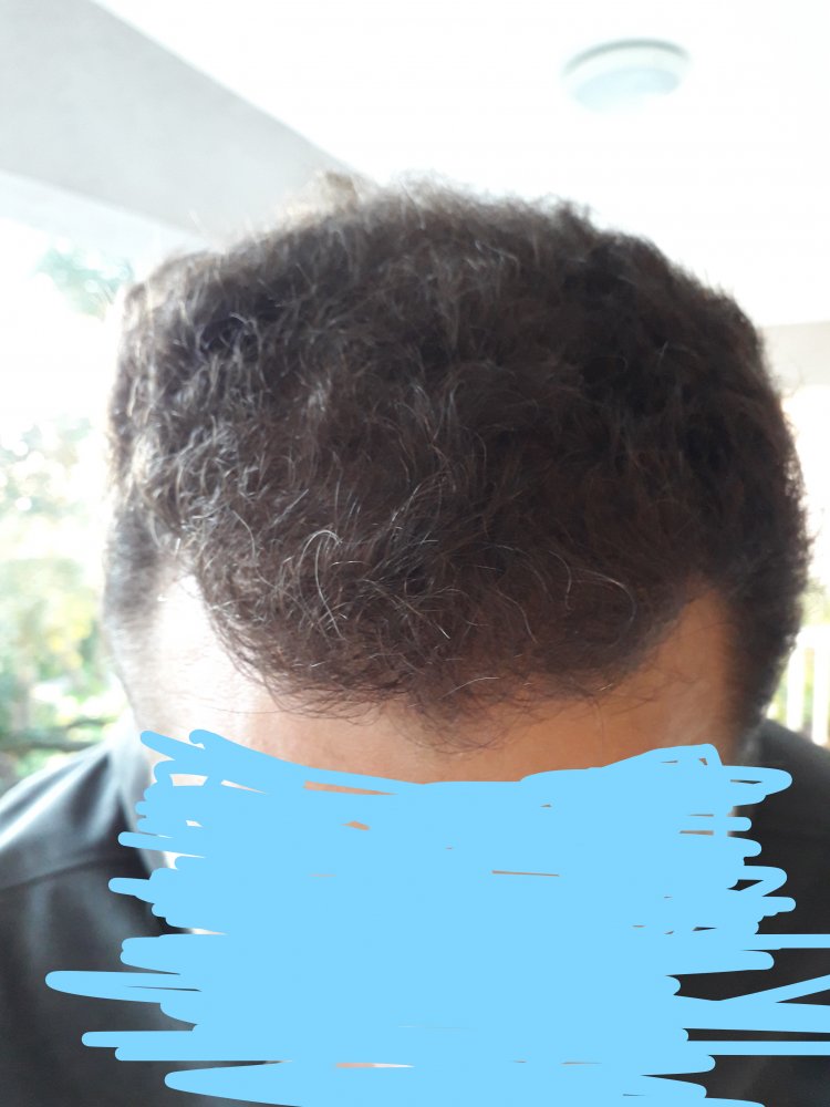 After Six Month 2.jpg