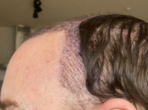 aftersurgery3.PNG