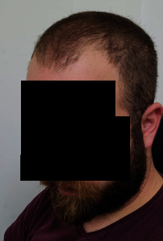 b.PNG