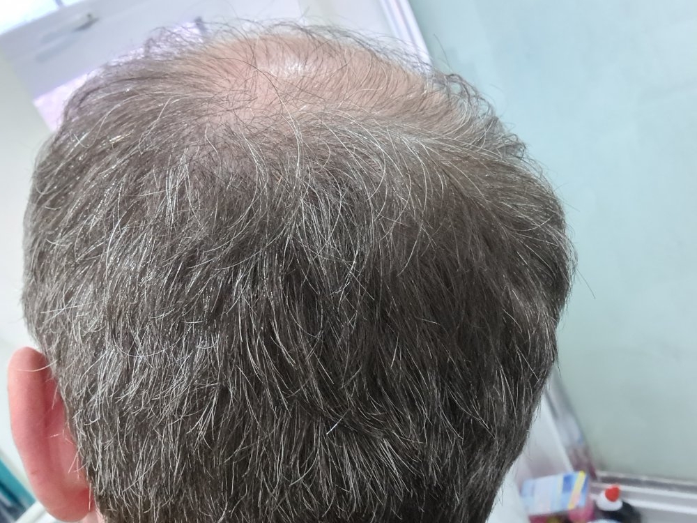 back.jpg