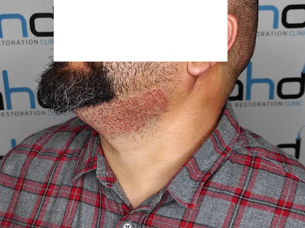 beard 1.jpeg