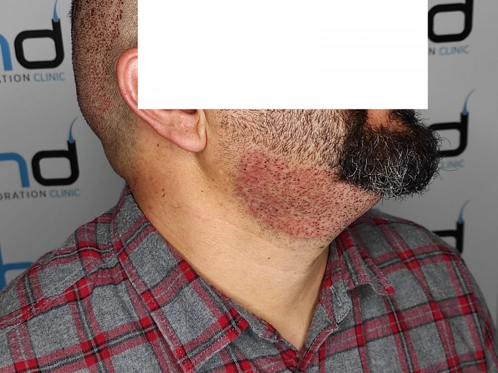 beard 2.jpeg