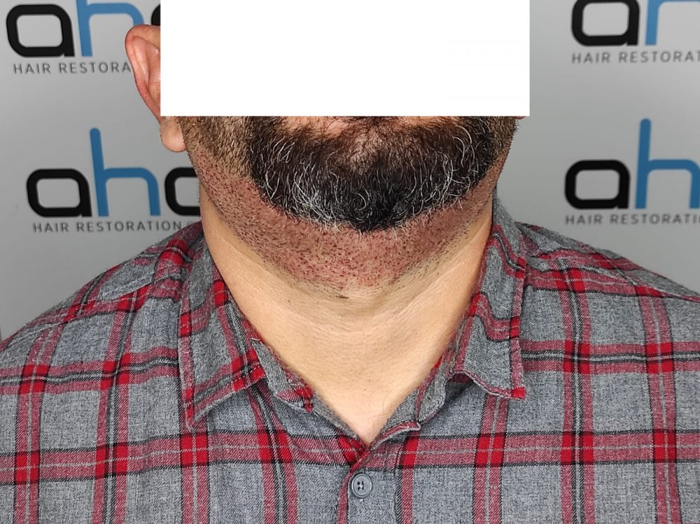 beard 4-2.jpeg