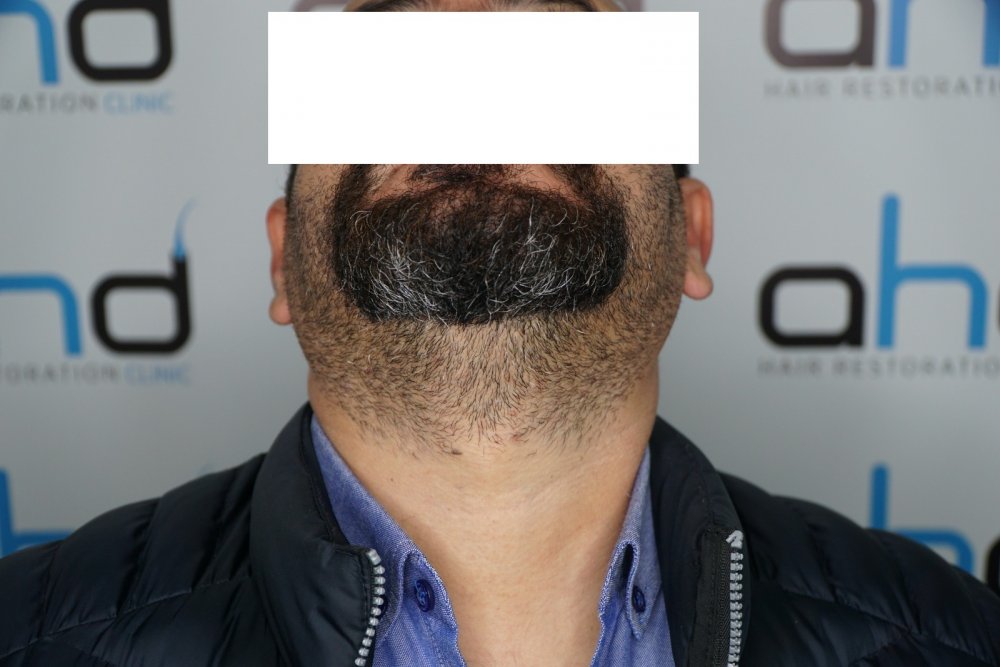 beard.jpeg
