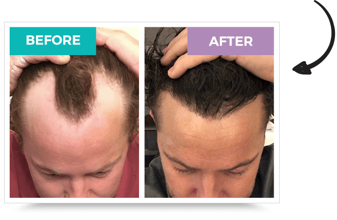 before-after-1.png