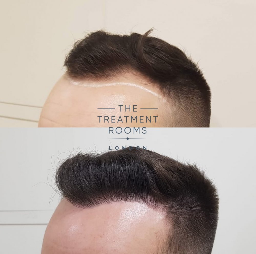 Before and after 2.jpg